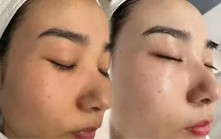 アイブロウ 愛維美水光美肌専門店 メンズレディースokのエステ・リラクイメージ