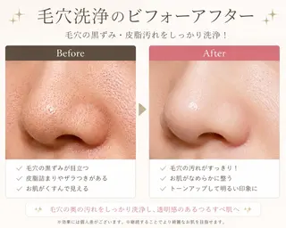 【都度払い制】 脱毛 ・エステ Linoのエステ・リラクイメージ