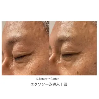 UnCouture 〜アンクチュール〜のエステ・リラクイメージ