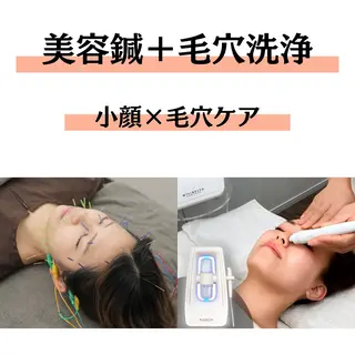 ハリサロンドオフ 美容鍼灸×小顔整体のエステ・リラクイメージ