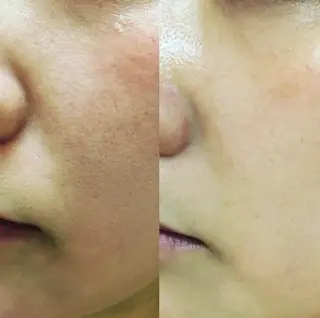 EYE LASH LAPISのエステ・リラクイメージ