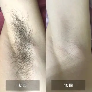 美肌・脱毛・痩身 サクラチャンスパのエステ・リラクイメージ