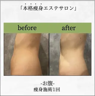 Micell beautyのエステ・リラクイメージ