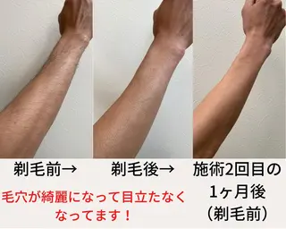 メンズ VANISH たやがきのエステ・リラクイメージ