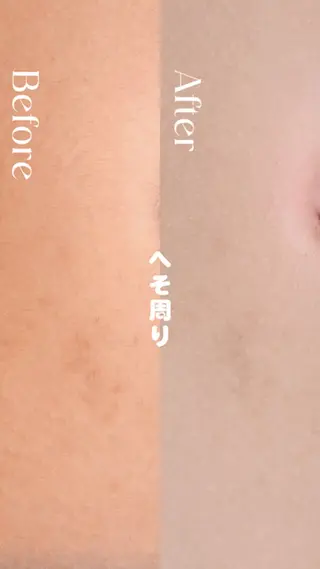 豊橋 |Hitomi シュガーリング専門店のその他イメージ