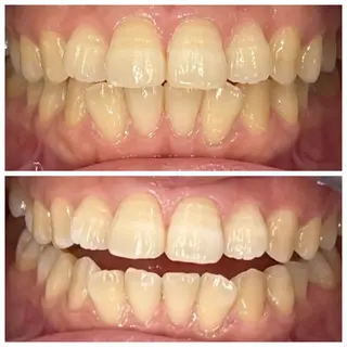 ホワイトニング🦷 ネイル💅LEAのその他イメージ