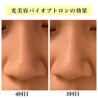 Bellesthe (ベルエステ)のエステ・リラクイメージ