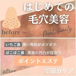 毛穴ケア✖️まつげ Feliceのエステ・リラクイメージ