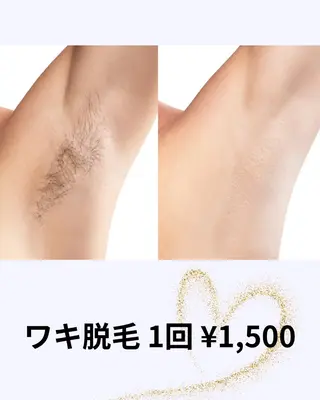 【都度払い可】 脱毛 サロンドジェシカのエステ・リラクイメージ