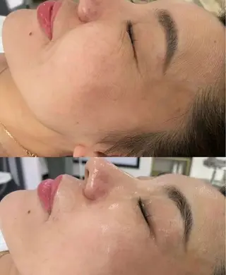 アイブロウ 愛維美水光美肌専門店 メンズレディースokのエステ・リラクイメージ