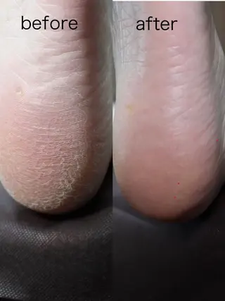 伊藤 菜緒のネイルデザイン