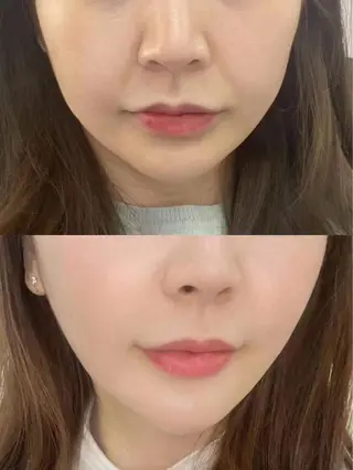 マツエク・マツパ 愛維美水光専門店 川崎彩鳳のエステ・リラクイメージ
