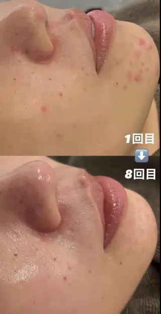 🩵Ni na🫧のエステ・リラクイメージ