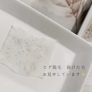 An Blossom 脱毛/茅ヶ崎/美咲のエステ・リラクイメージ