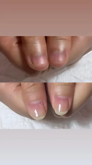 ネイル 自爪育成・巻き爪 補正講師 津蔵のネイルデザイン
