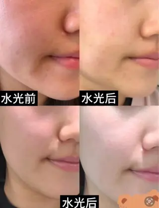 ネイル 愛維美水光専門店 川崎彩鳳のエステ・リラクイメージ