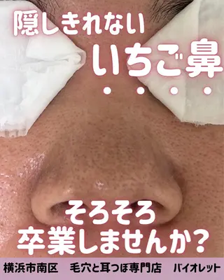 毛穴と耳つぼ専門店 バイオレット　りののその他イメージ