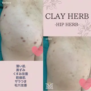 美肌&アロマ🌸 nana 中目黒のエステ・リラクイメージ