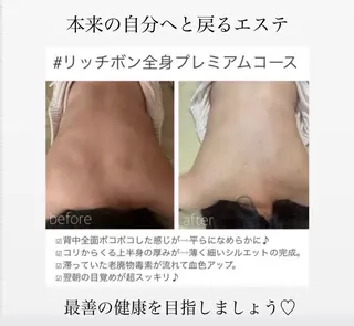 豊胸級バストUPなら ミラクルバスト向日葵のエステ・リラクイメージ