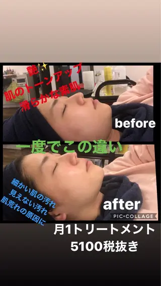宇野澤 彩加のエステ・リラクイメージ