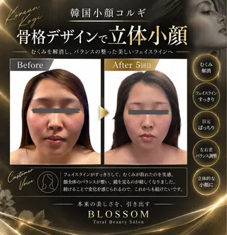 BLOSSOM 菊地のその他イメージ