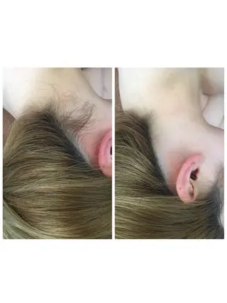 脱毛&肌質改善サロン shandeelのエステ・リラクイメージ