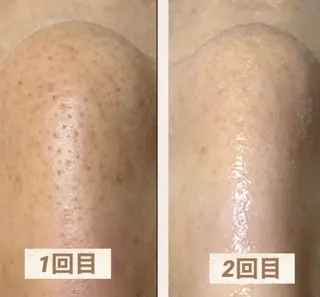 佐々木 風奈のエステ・リラクイメージ