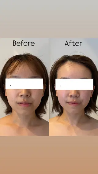 Hariccuma 荒井🧸🪡のエステ・リラクイメージ