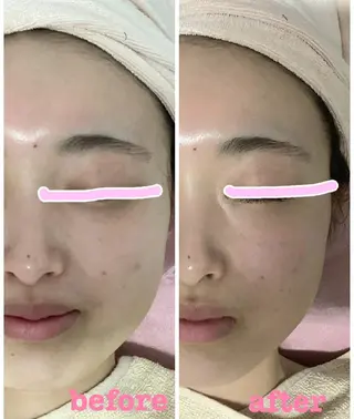 小顔エステ サクラ🌸ベルのエステ・リラクイメージ
