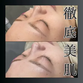 LiZA エステティックサロンのエステ・リラクイメージ