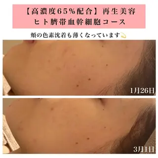 Bellesthe (ベルエステ)のエステ・リラクイメージ