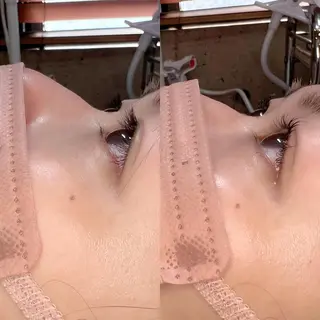マツエク・マツパ 17日空き有♡ ERIKA♡のマツエク・マツパデザイン