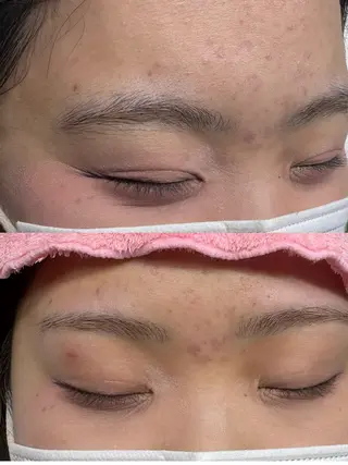 アイブロウ トータルビューティー サロン・Ｎの眉毛・アイブロウイメージ