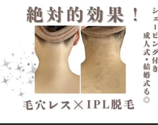 🌷MURA 毛穴・顔脱毛🌷のエステ・リラクイメージ
