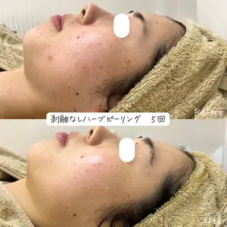 肌質改善サロン renew/ウエキのエステ・リラクイメージ