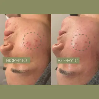 表参道エステ痩身 hiromiのエステ・リラクイメージ