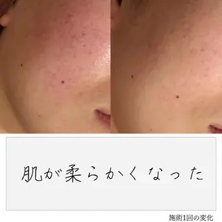 ニキビ経験者が施術 する専門サロン🌻のエステ・リラクイメージ
