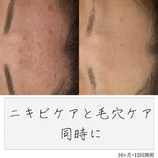 ニキビ経験者が施術 する専門サロン🌻のエステ・リラクイメージ