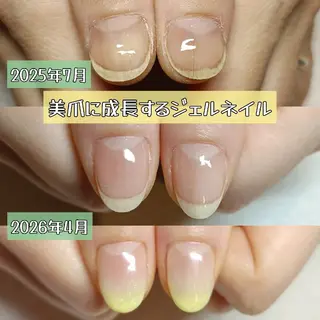 ネイル 深爪矯正/爪育成ケア manie nailのネイルデザイン