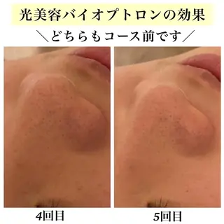 Bellesthe (ベルエステ)のエステ・リラクイメージ