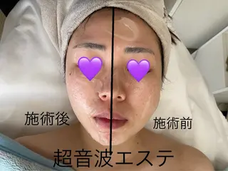 COCO beautyサロンのエステ・リラクイメージ