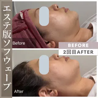 小顔矯正・美肌ケア 池田 桃花のエステ・リラクイメージ