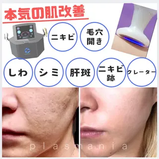 小顔★美肌★ 平日限定★¥6600のエステ・リラクイメージ