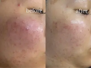 肌質改善×癒しサロン Ryanのエステ・リラクイメージ