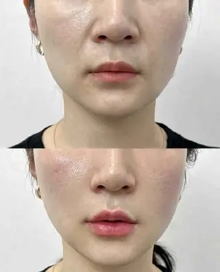 ネイル 愛維美水光専門店 川崎彩鳳のエステ・リラクイメージ