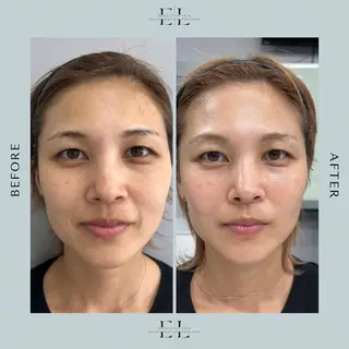 White labo 須谷のエステ・リラクイメージ