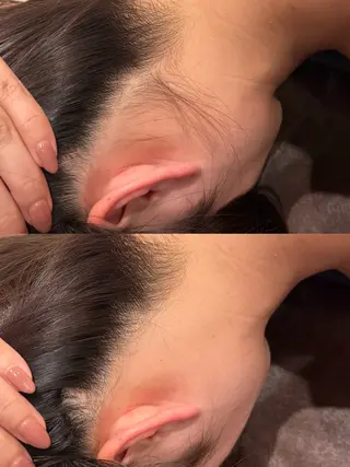 脱毛サロン Exsior.博多店のエステ・リラクイメージ