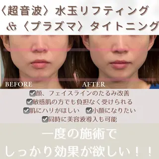小顔・美肌 ルミエールのエステ・リラクイメージ