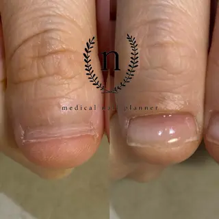 ネイル salon de fika【中崎町】のネイルデザイン