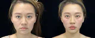 ネイル 愛維美水光専門店 川崎彩鳳のエステ・リラクイメージ